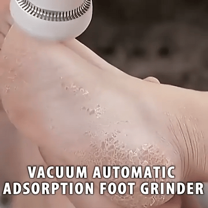 Electric Callus Remover